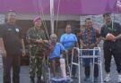 Rumkital Marinir Cilandak Tangani Pasien Penyakit Kulit Langka Asal NTT, Leonardus Kini Miliki Kaki Palsu